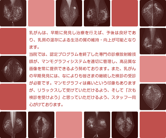 乳がんは、早期に発見し治療を行えば、予後は良好であり、乳房の温存による生活の質の維持・向上が可能となります。当院では、認定プログラムを終了した専門の診療放射線技師が、マンモグラフィシステムを適切に管理し、高品質な画像を常に提供できるよう努めております。また、（読影医師について何か…）乳がんの早期発見には、なによりも皆さまの継続した検診の受診が必要です。マンモグラフィは痛いという印象もありますが、リラックスして受けていただけるよう、そして「次も検診を受けよう」と思っていただけるよう、スタッフ一同心がけております。